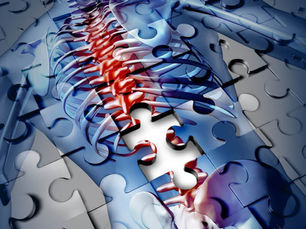 Which Spinal Cord Stimulator (SCS) is Best For Me?