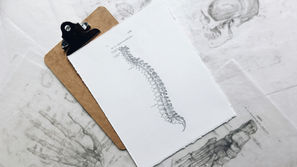Scoliosis: Genetic Factors and Family History