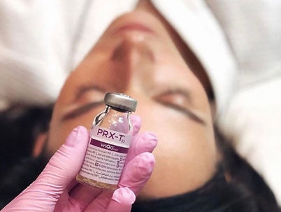 PRX-T33 Peel