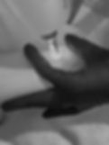 Thumbnail: Laser Tattoo Removal - 6 Sessions