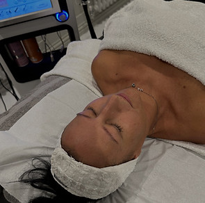 Client on couch in preperation to have a HydraPeel Treatment