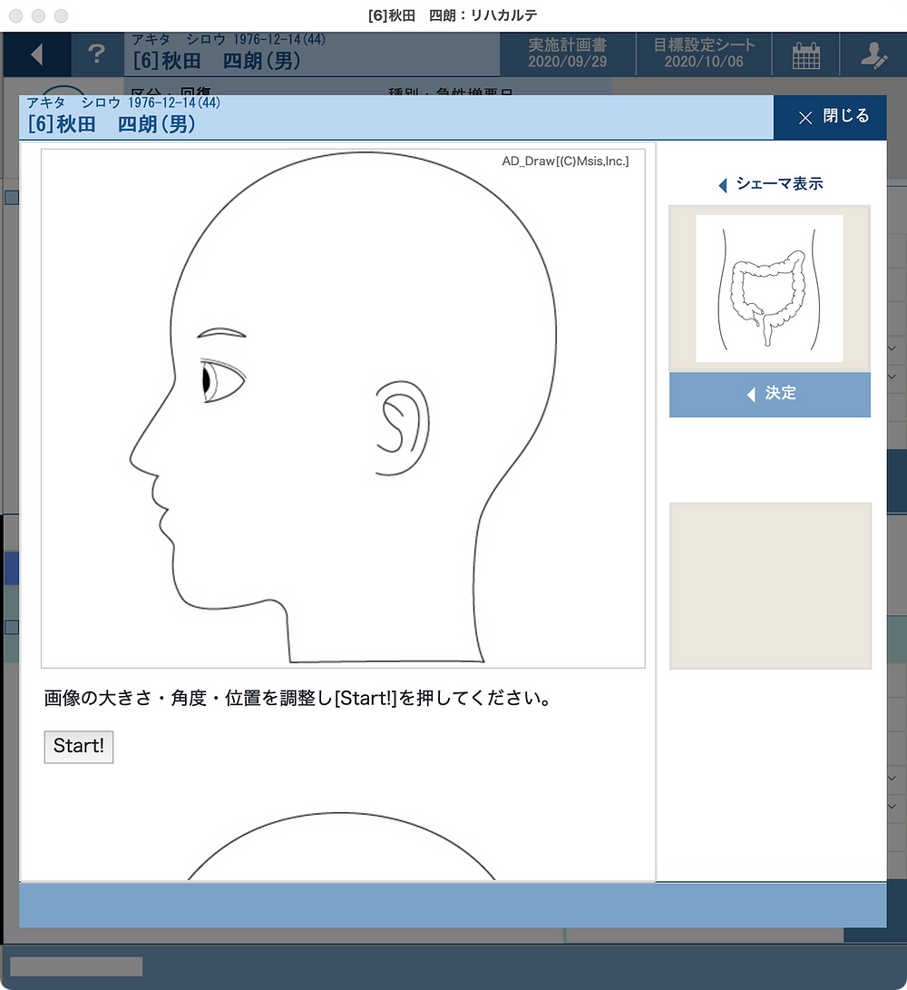 シェーマ画像