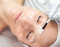 Chemical Peels at New Age Aesthetics