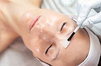 Chemical Peels at New Age Aesthetics