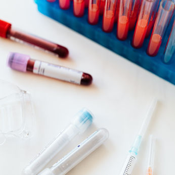 КОАГУЛАЦИЯ, COAGULATION, лаборатория, laboratory
