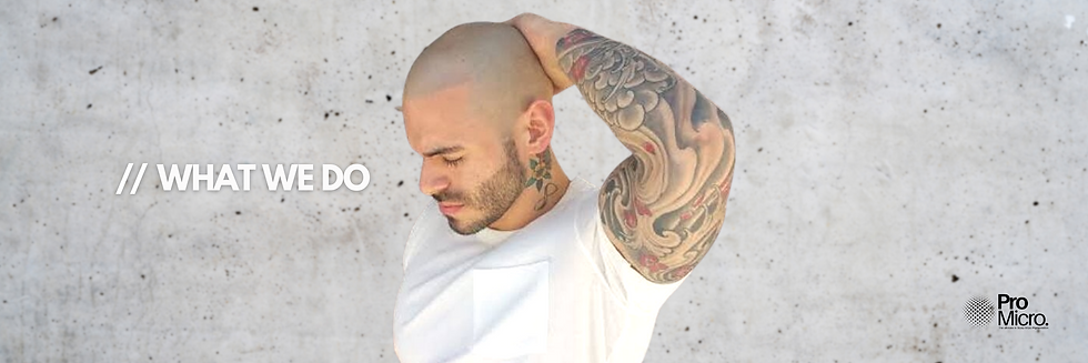 SMP_SMP_Gold_Coast_Scalp_Micro_Pigmentation_Gold_Coast_Scalp_Micro_Pigmentation_Australia_Hair_Loss_Solutions