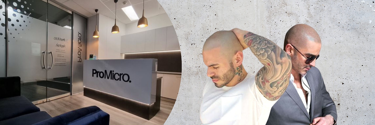 SMP_SMP_Gold_Coast_Scalp_Micro_Pigmentation_Gold_Coast_Scalp_Micro_Pigmentation_Australia_Hair_Loss_Solutions