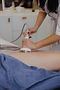 Cavitation Pudsey treatment using radio frequency device.