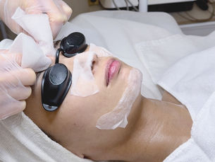 Woman receiving a professional facial extraction treatment with her eyes covered in a spa setting
