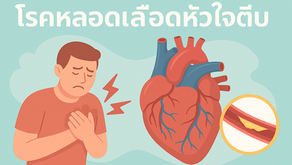 อาการเตือน “หลอดเลือดหัวใจตีบ” ที่ไม่ควรมองข้าม 