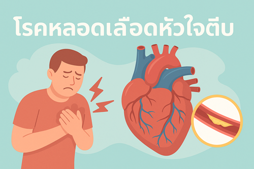 อาการเตือน “หลอดเลือดหัวใจตีบ” ที่ไม่ควรมองข้าม 