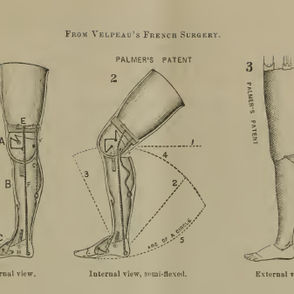The Civil War Veteran With An Artificial Limb
