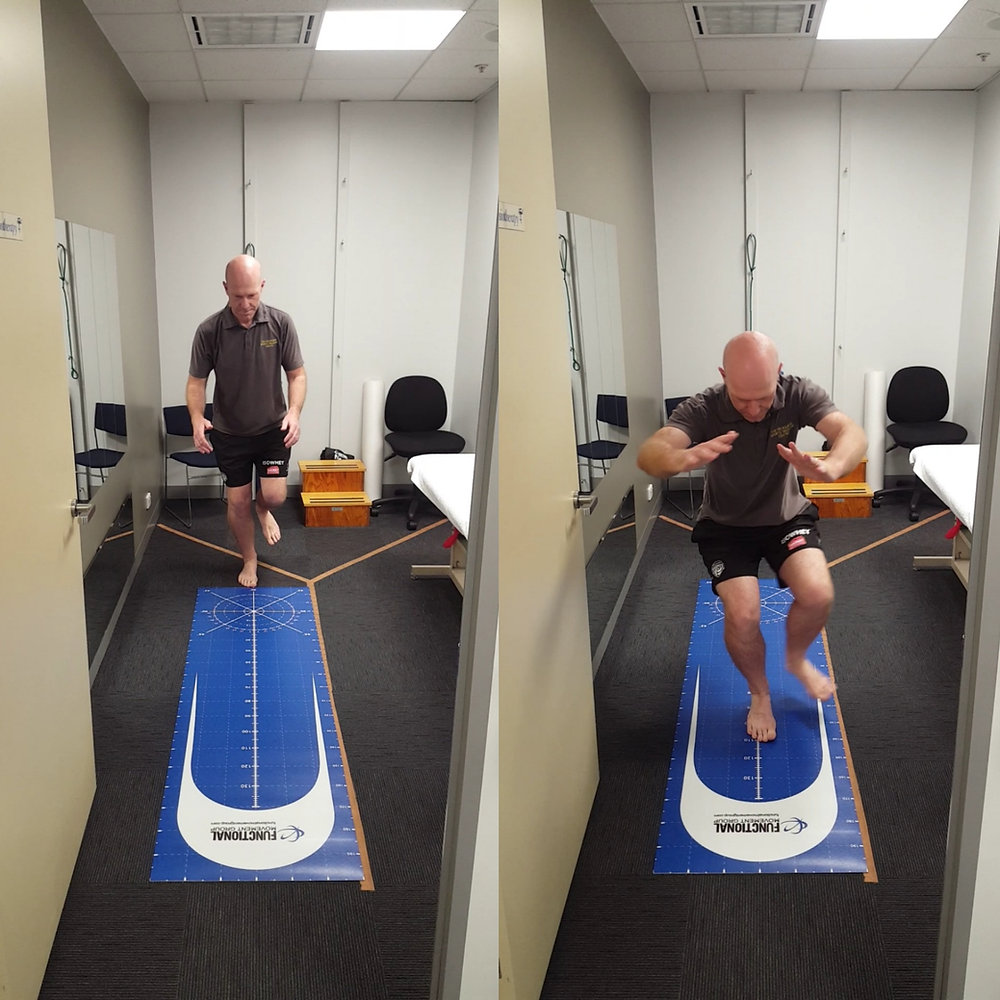 Return to Sport Testing: Single Leg Hop Test.