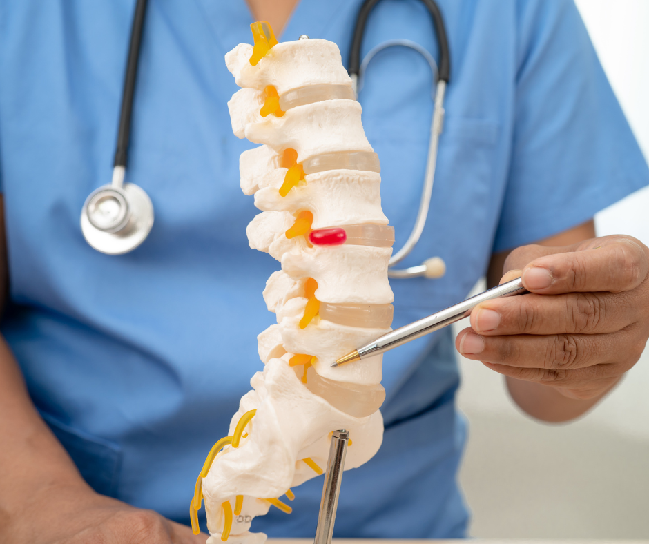 sciatica, cherry health center