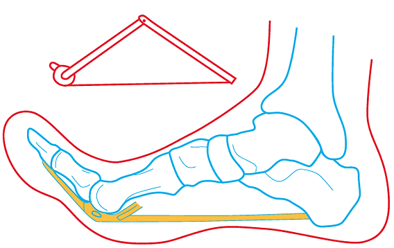 Engineering of the foot: The windlass mechanism