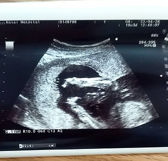 二人目 妊娠さん_2.jpg