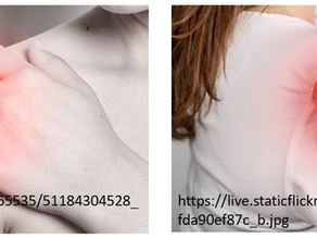 Healing a Shoulder/Chest Injury