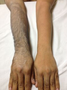 FULL ARM WAX