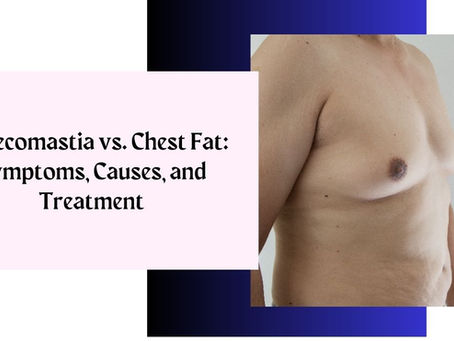 Gynecomastia vs. Chest Fat: Symptoms, Causes, and Treatment