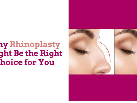 Why Rhinoplasty Might Be the Right Choice for You