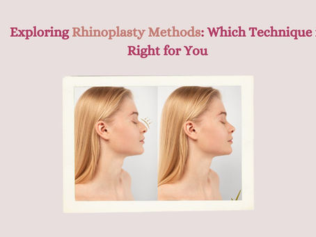 Exploring Rhinoplasty Methods: Which Technique is Right for You?