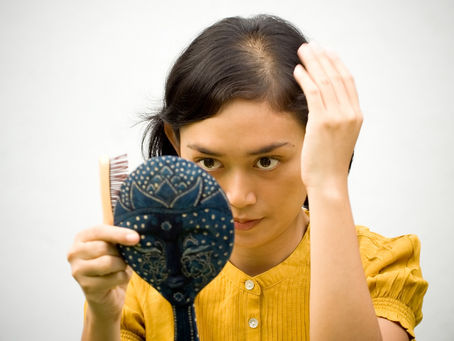 10 Cara Mengatasi Kebotakan, Tak Perlu Transplantasi Rambut