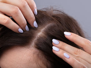 Struggling with thinning hair in Bali? Find out if Hair extensions are right to add volume & length
