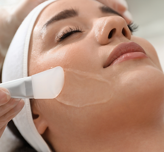 Chemical peel.png