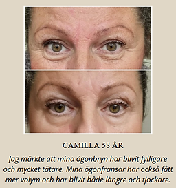 Camilla results collagen after 41 dgr.png