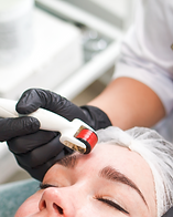 MICRONEEDLING.png