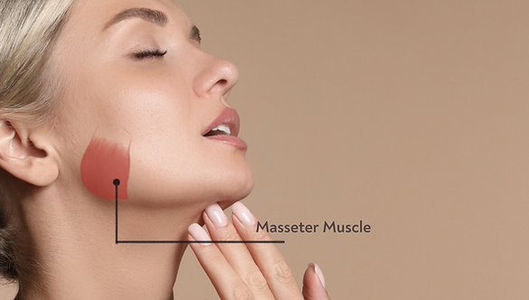 an illustration of the masseter muscle in a young woman's face.
