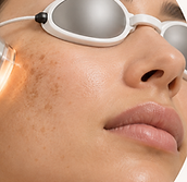 Prompt treatment of inflammatory skin conditions