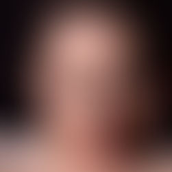 Coping with Chemotherapy and Fatigue