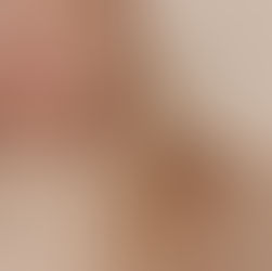 Tips for Getting Thicker Hair