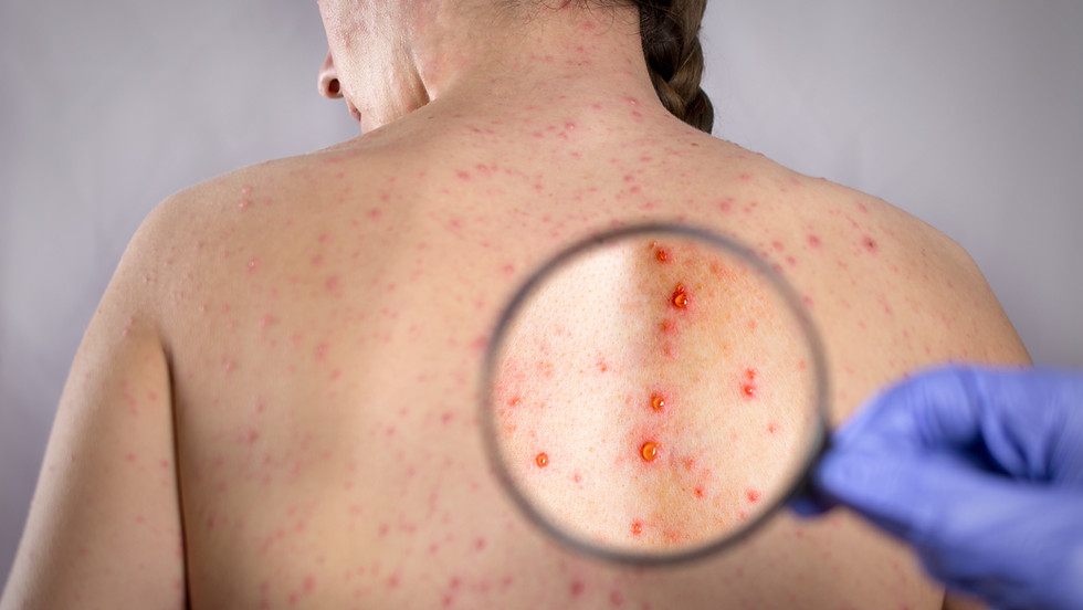 DermDoc