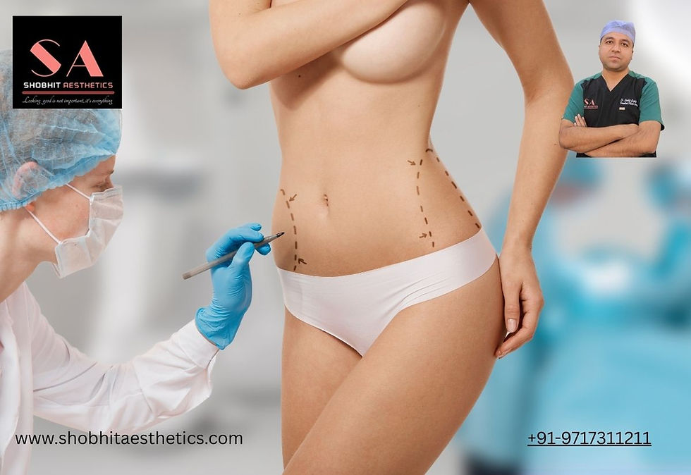 Liposuction Surgery in Delhi: A Complete Guide by Experts at Shobhit Aesthetics