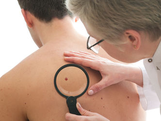 Check your skin this winter-Why getting a skin cancer check in winter is highly advised