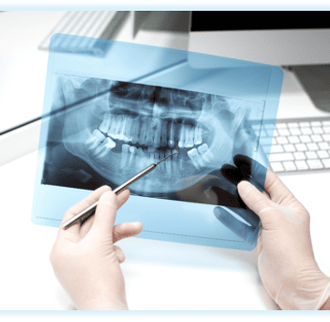 Rx Panoramica Serv I.png