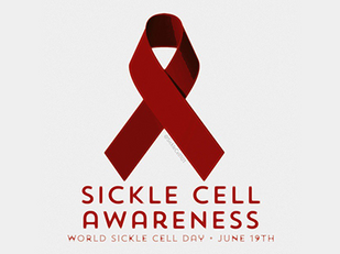 World Sickle Cell Day. 10 Facts And Awareness Process To Smarter Living With Sickle Cell Disease (SC