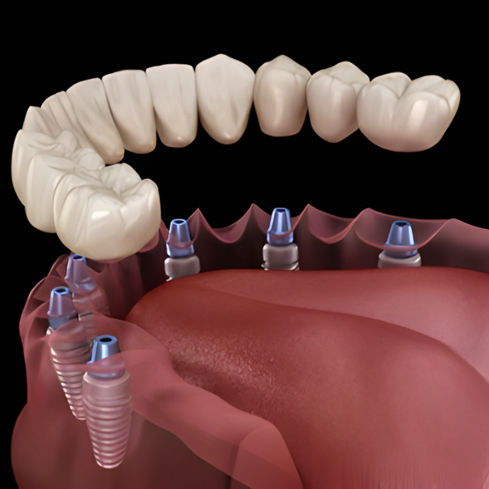 Invisalign Consultation