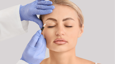Blefaroplastia: rejuvenecer la mirada sin cambiar tu expresión.