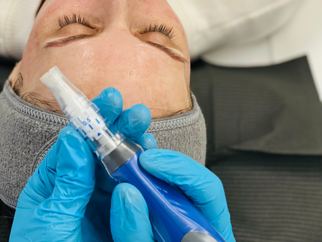 Microneedling: Everything you need to know