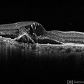 ASRS-RIB-Image-116548.jpg