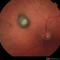 ASRS-RIB-Image-130127.jpg