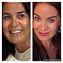 Janie before after.jpg