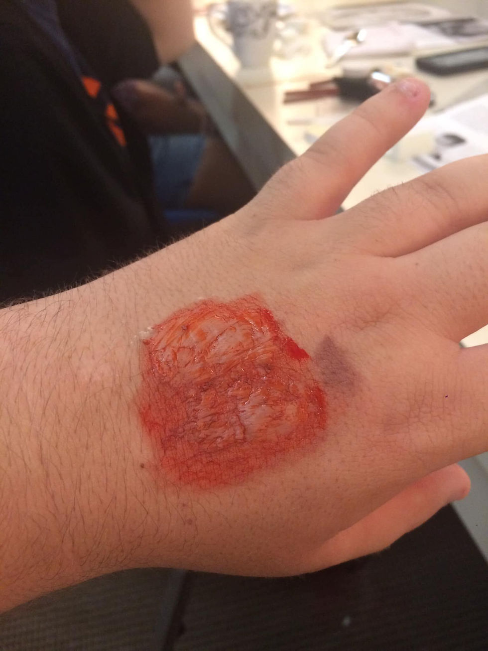 Scab