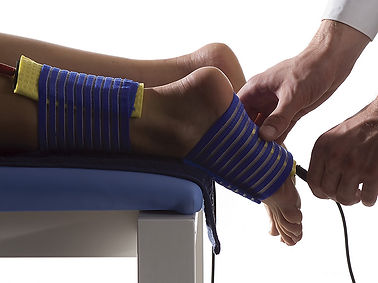 TENS electrotherapy