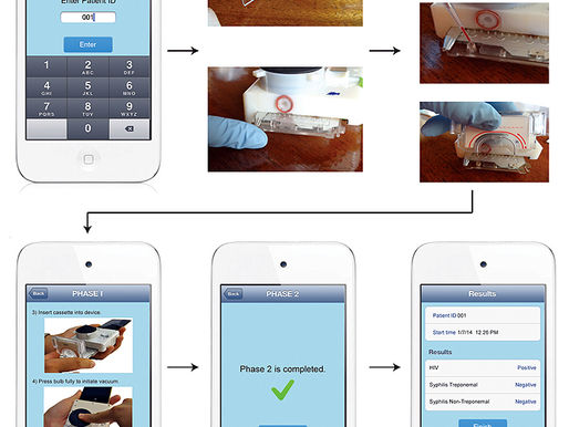 Dispositivo para diagnosticar SIDA y sífilis con un teléfono móvil