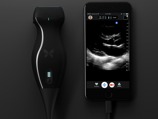 Butterfly iQ, el sistema de ultrasonidos que podría revolucionar la imagen médica