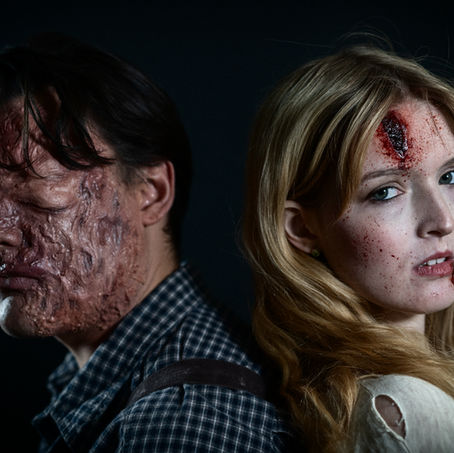 Prosthetics